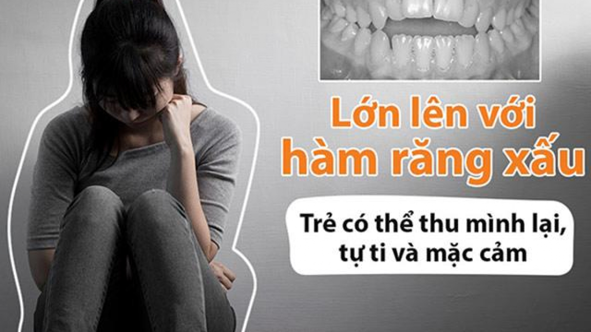 Tự ti với hàm răng xấu - Dr. Hải Yến Yteeth