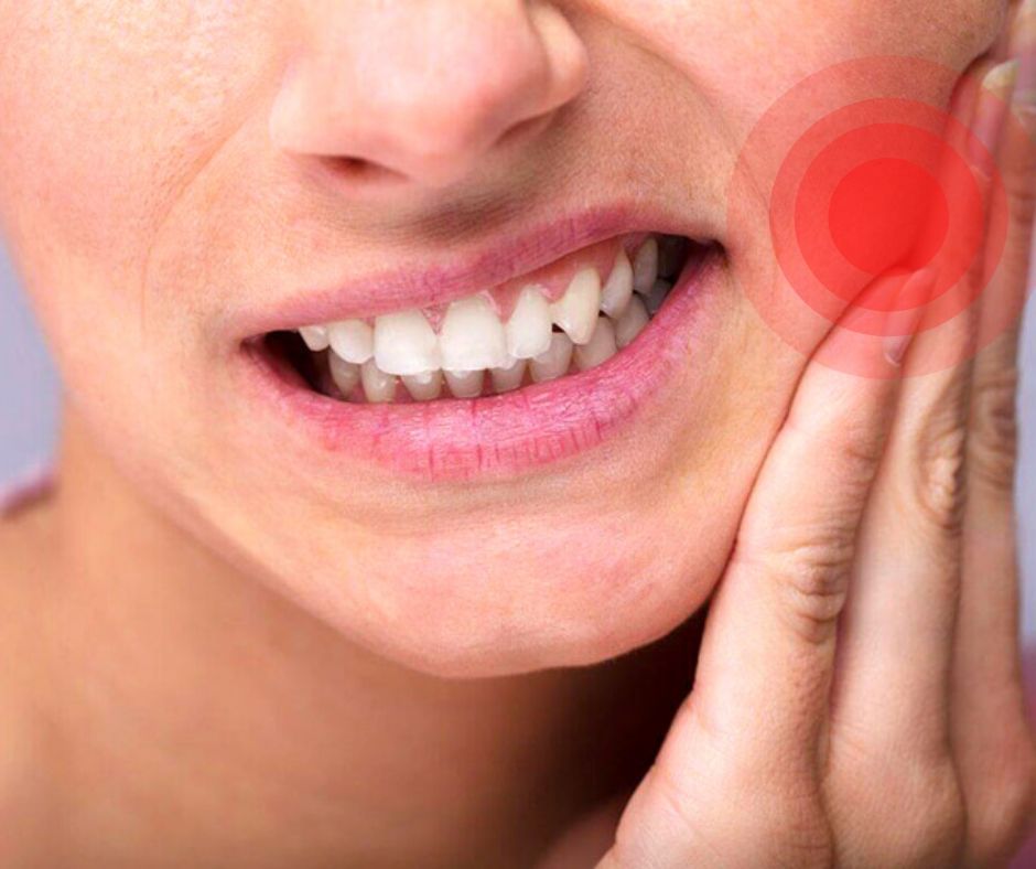 Sâu răng vào tủy gây đau răng - Nha khoa Yteeth